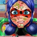 Ladybug Face Skin Surgery